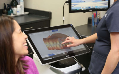 Teeth Whitening in Dunbar Vancouver for Brighter Smile